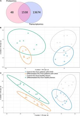 Multi-omics of in vitro aortic valve calcification